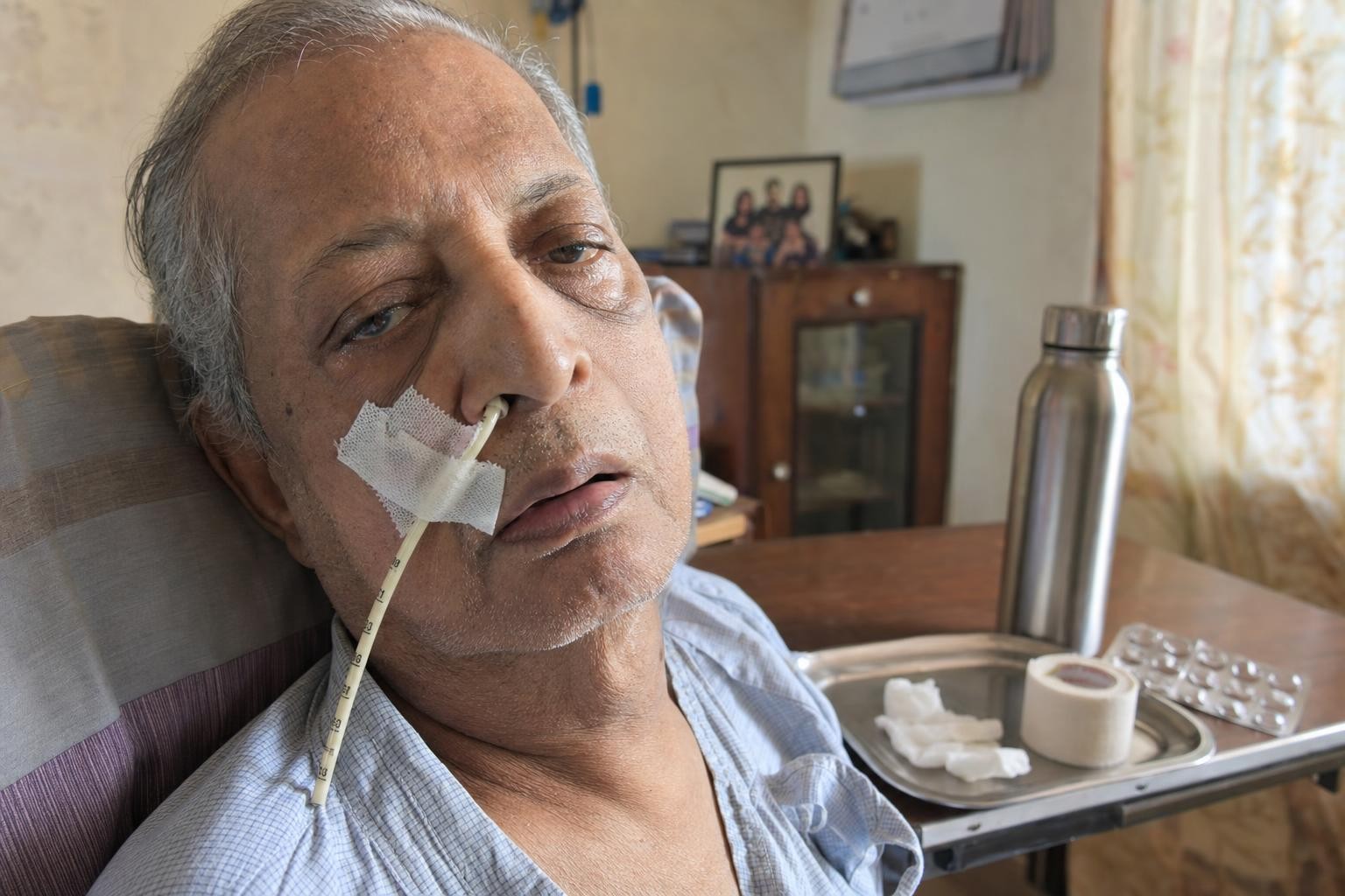 A close view of a nasogastric tube secured with tape against a patient's cheek, the external length marking visible